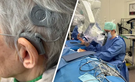 Hoorimplantaten AZ Herentals