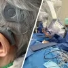 Hoorimplantaten AZ Herentals